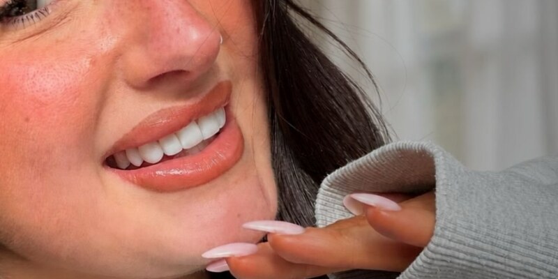Teeth whitening results at Seren Dental